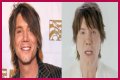 John Rzeznik Facelift | Goo Goo Dolls Frontman Plastic Surgery Before And After