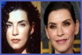 Julianna Margulies Doesn’t Look Natural After Plastic Surgery!