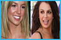What’s Up with Britney Spears’ Smile? The Scoop on Her Noticeable Gap Teeth